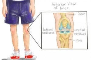 Meniscus Tear Treatment Box Hill